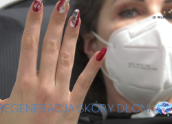 Tropokolagen Guna – regeneracja skóry dłoni